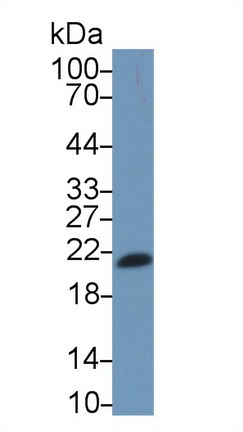 MAB955Hu21.jpg