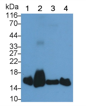 Monoclonal Antibody to Superoxide Dismutase 1 (SOD1)