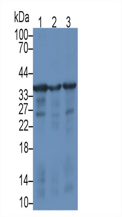 Monoclonal Antibody to Syndecan 1 (SDC1)