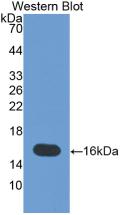 Monoclonal Antibody to Tenascin C (TNC)