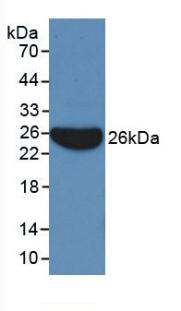 Monoclonal Antibody to Apolipoprotein B (APOB)