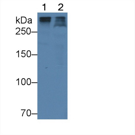 Monoclonal Antibody to Apolipoprotein B (APOB)