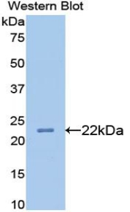 Monoclonal Antibody to Apolipoprotein B (APOB)