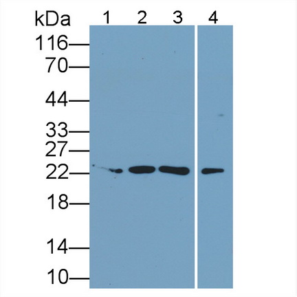 Monoclonal Antibody to Interleukin 34 (IL34)