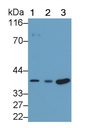 Monoclonal Antibody to Interleukin 34 (IL34)