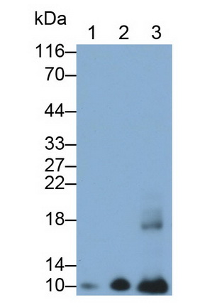 Monoclonal Antibody to S100 Calcium Binding Protein A2 (S100A2)