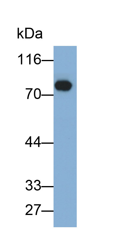 Monoclonal Antibody to Transferrin (TF)