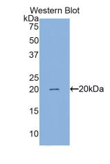 Monoclonal Antibody to Survivin (Surv)