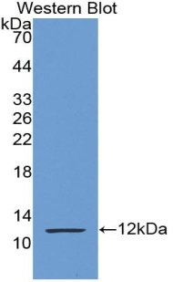 Monoclonal Antibody to S100 Calcium Binding Protein P (S100P)