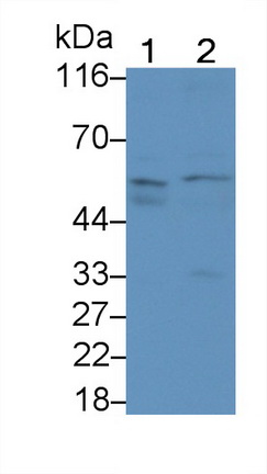 Monoclonal Antibody to Activin A Receptor Type II A (ACVR2A)