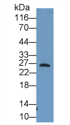 Monoclonal Antibody to Noggin (NOG)