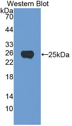 Monoclonal Antibody to Noggin (NOG)