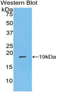 Monoclonal Antibody to Collagen Type VIII Alpha 1 (COL8a1)