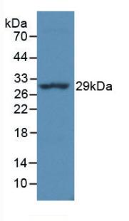 Monoclonal Antibody to HLA Class II Histocompatibility Antigen, DR Alpha Chain (HLA-DRA)