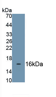 Monoclonal Antibody to Neurotrophic Tyrosine Kinase Receptor Type 1 (NTRK1)