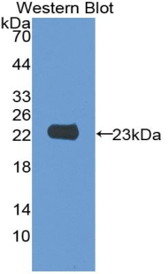 Monoclonal Antibody to Zyxin (ZYX)