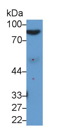 Monoclonal Antibody to Afamin (AFM)