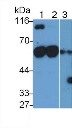 Monoclonal Antibody to Antithrombin (AT)