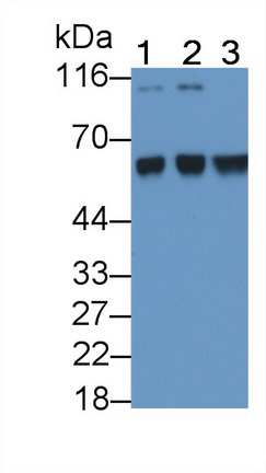 Monoclonal Antibody to Antithrombin (AT)