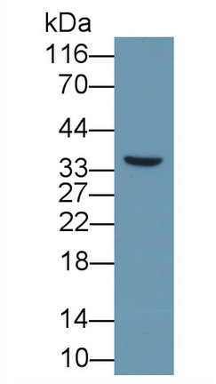 Monoclonal Antibody to Ectonucleotide Pyrophosphatase/Phosphodiesterase 2 (ENPP2)