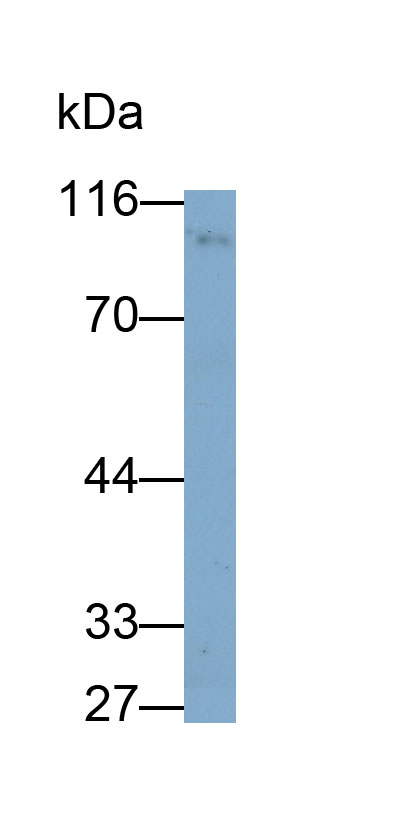 Monoclonal Antibody to Ectonucleotide Pyrophosphatase/Phosphodiesterase 2 (ENPP2)