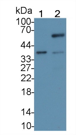 Monoclonal Antibody to Caudal Type Homeobox 2 (CDX2)