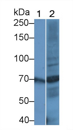 Monoclonal Antibody to Carnitine Acetyltransferase (CRAT)