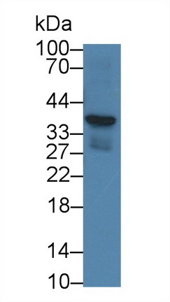 Monoclonal Antibody to Corticotropin Releasing Hormone Binding Protein (CRHBP)