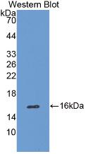 Monoclonal Antibody to Catalase (CAT)