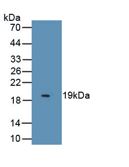 Monoclonal Antibody to Endothelial Cell Specific Molecule 1 (ESM1)