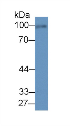 Monoclonal Antibody to Fibulin 1 (FBLN1)