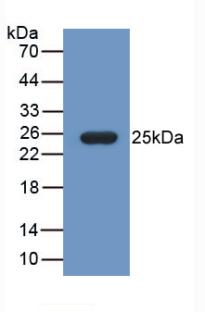 Monoclonal Antibody to Fibulin 1 (FBLN1)