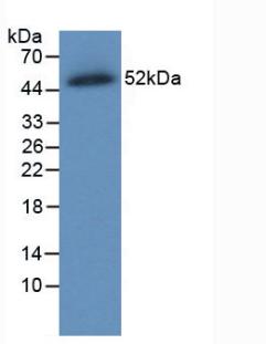 Monoclonal Antibody to Ferroportin (FPN)