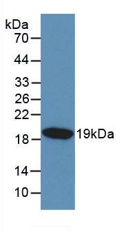 Monoclonal Antibody to Kisspeptin 1 (KISS1)