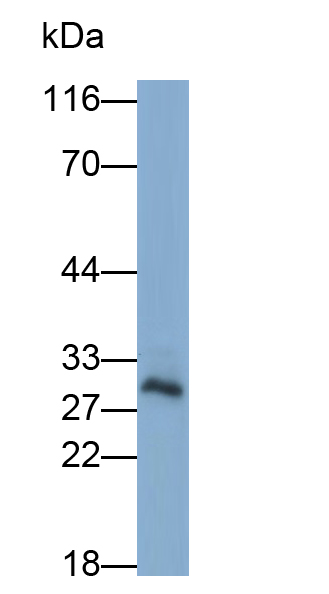 Monoclonal Antibody to Mitochondrial Uncoupling Protein 2 (UCP2)