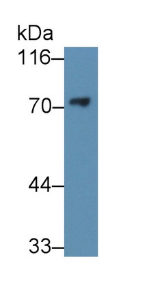 Monoclonal Antibody to Methyl CpG Binding Protein 2 (MECP2)