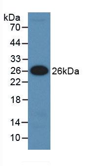 Monoclonal Antibody to Insulin Like Growth Factor Binding Protein 5 (IGFBP5)