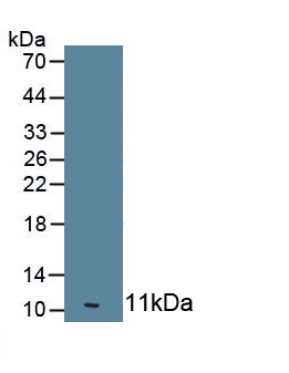 Monoclonal Antibody to 2',5'-Oligoadenylate Synthetase 1 (OAS1)