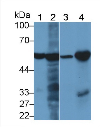 Monoclonal Antibody to Phenylalanine Hydroxylase (PAH)