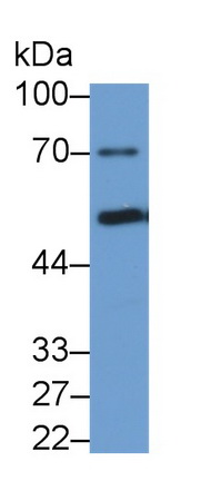 Monoclonal Antibody to Phenylalanine Hydroxylase (PAH)