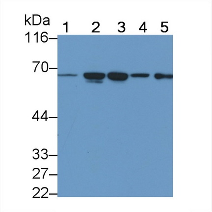 Monoclonal Antibody to Transmembrane Protease, Serine 2 (TMPRSS2)