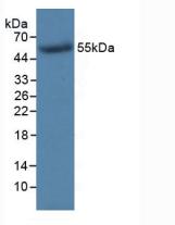 Monoclonal Antibody to Thymidine Kinase 1, Soluble (TK1)