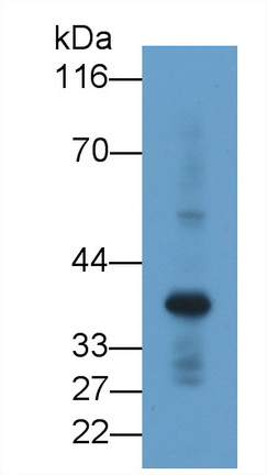 Monoclonal Antibody to Renalase (RNLS)