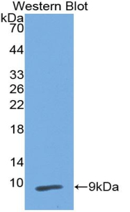 Monoclonal Antibody to Peptidase Inhibitor 3, Skin Derived (PI3)