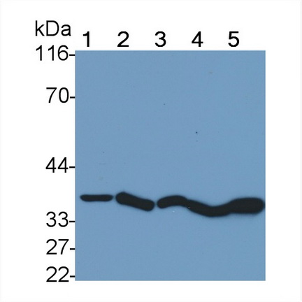 Monoclonal Antibody to Cathepsin B (CTSB)