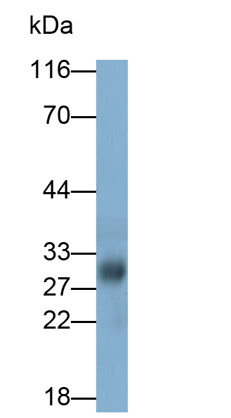 Monoclonal Antibody to Cathepsin B (CTSB)