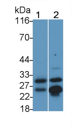 Monoclonal Antibody to Cathepsin B (CTSB)