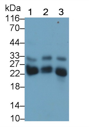 Monoclonal Antibody to Cathepsin B (CTSB)