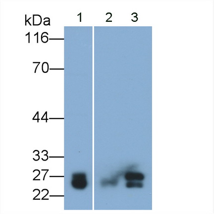 Monoclonal Antibody to Cathepsin B (CTSB)