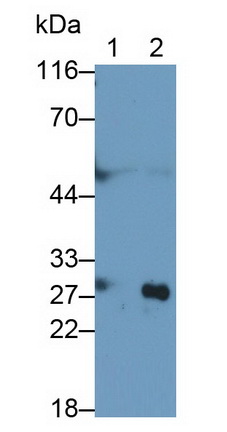 Monoclonal Antibody to Cathepsin B (CTSB)